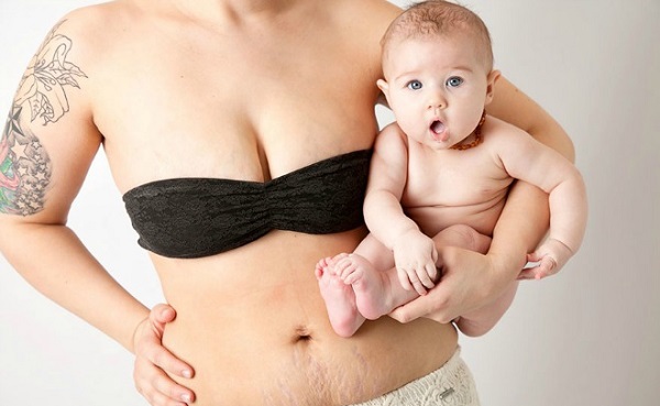 Tập cơ bụng giảm mỡ bụng sau khi sinh