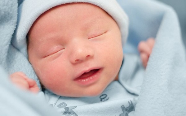 Trẻ sơ sinh bị vàng da và cách điều trị hiệu quả